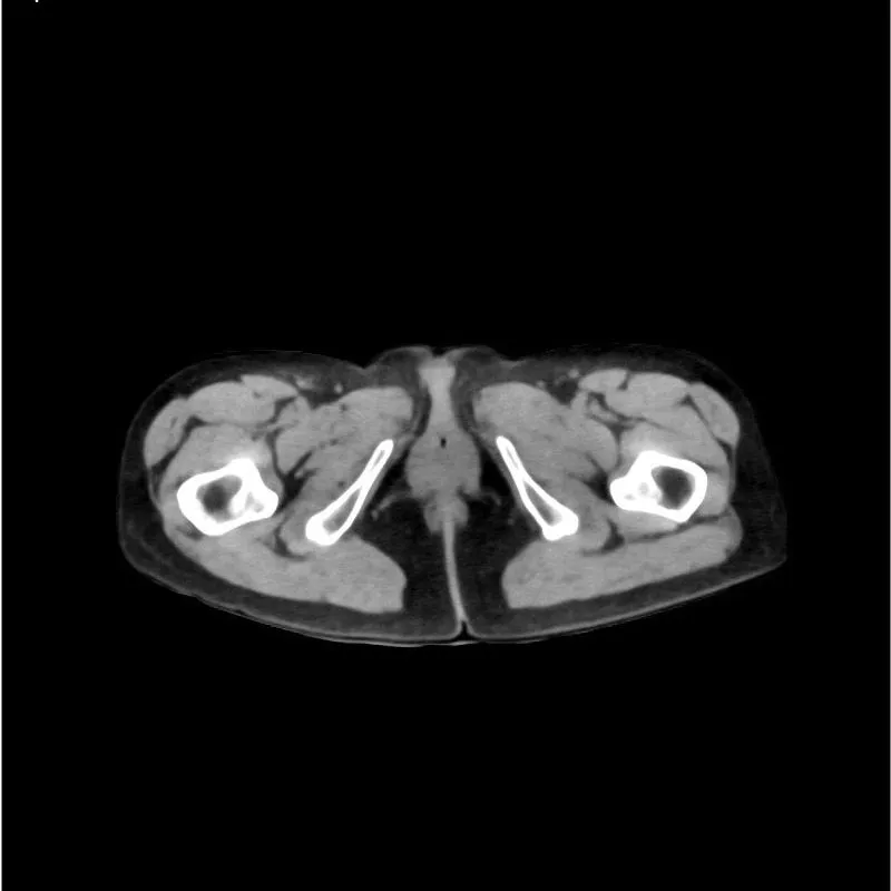 Abdomen and Pelvis Phantom - Native