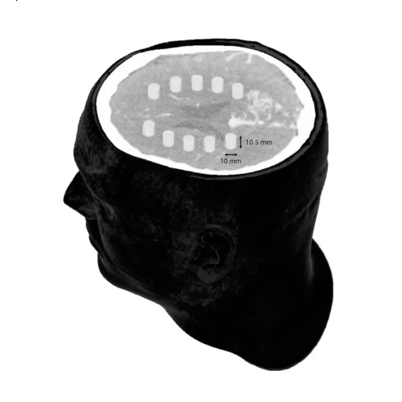 Head and Neck Phantom - CTA AVM / lesion