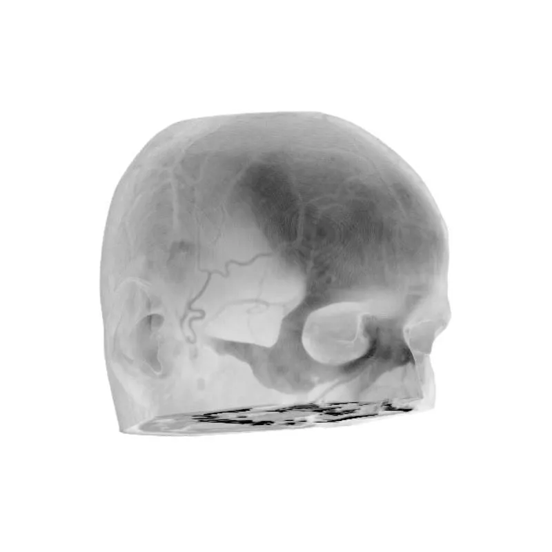 Head Phantom - CTA