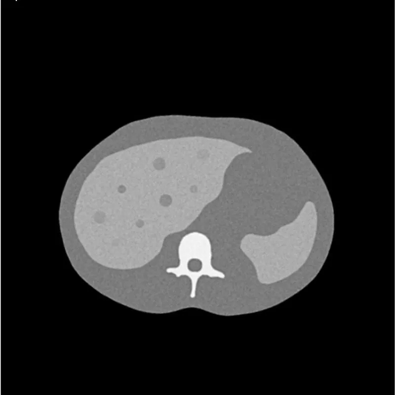 Uniform Abdomen Phantom - Low-Contrast Spheres